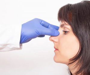 broken nose nasal bump nasal tip